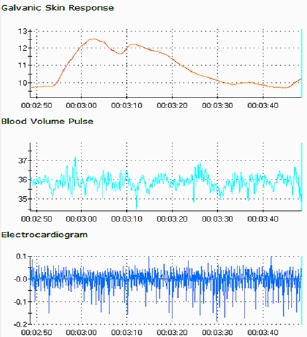 Biosignals