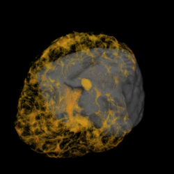 cutting plane + MRI