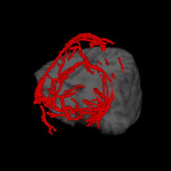 cutting plane + blood vessels