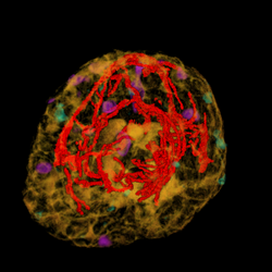 blood vessels + fMRI + PET + MRI